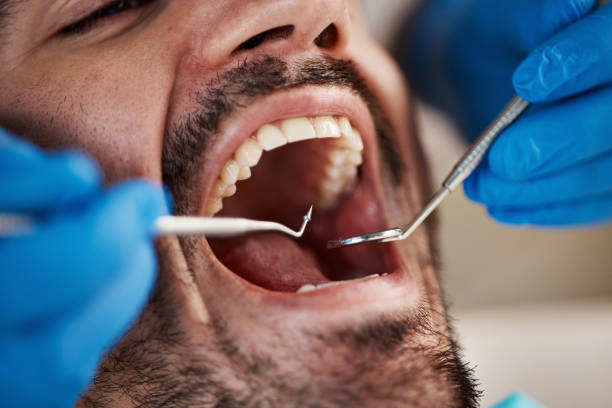 Best Root Canal Treatment  in Farmersville, CA